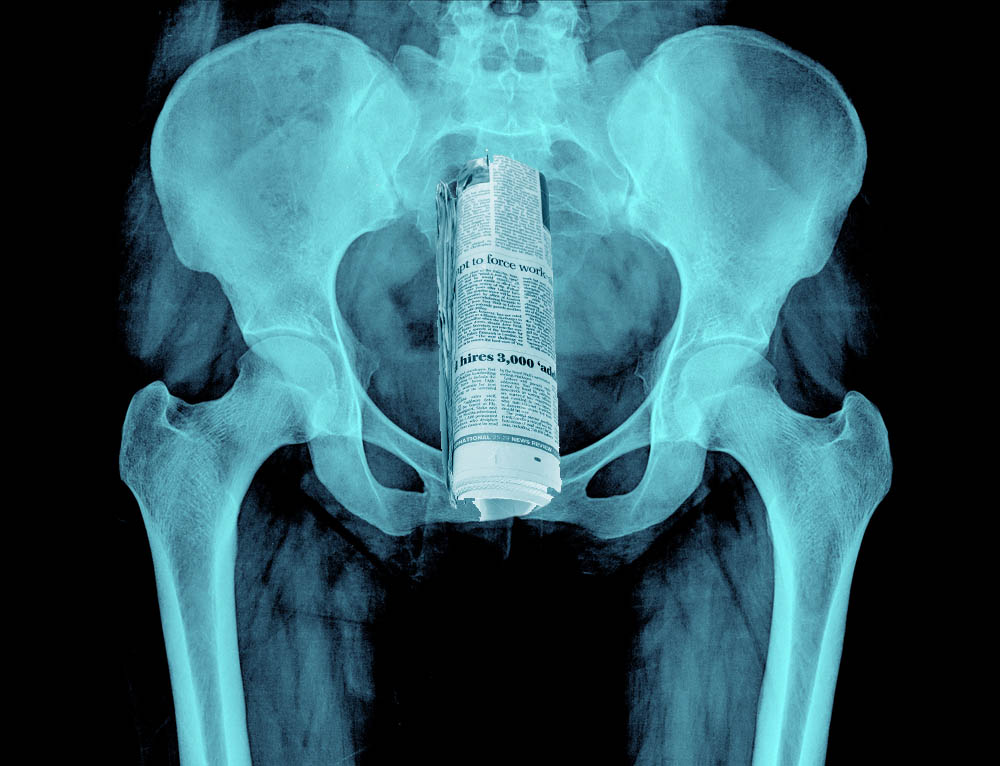 Shocking X Rays Reveal The Strange Items Irish People Use During Sex Waterford Whispers News